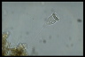 Vorticella