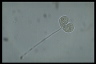 Vorticella