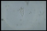 Vorticella