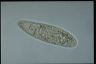 Paramecium multimicronucleatum