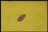 Paramecium caudatum, macronuclear inclusion body