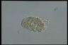 Paramecium caudatum, macronuclear inclusion body