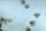 Vorticella