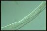 Spirostomum teres