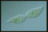 Spirostomum teres