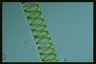 Spirogyra