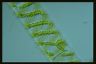 Spirogyra