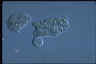 Paramecium caudatum, macronuclear inclusion body