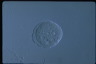 Paramecium caudatum, macronuclear inclusion body