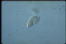 Paramecium caudatum, macronuclear inclusion body