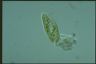 Paramecium bursaria