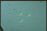 Acanthocystis