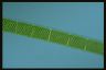 Spirogyra