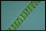 Spirogyra