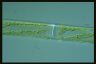 Spirogyra