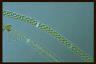 Spirogyra