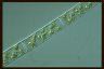 Spirogyra