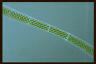 Spirogyra