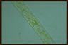 Spirogyra