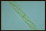 Spirogyra