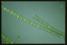 Spirogyra