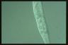 Spirostomum ambiguum