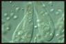 Paramecium caudatum, food vacuole