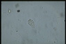 Vorticella