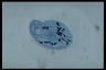 Chilodonella