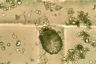 Codonellopsis