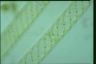 Spirogyra