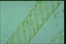 Spirogyra