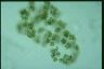 Microcystis