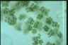 Microcystis