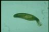 Euglena spirogyra