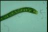 Euglena ehrenbergii