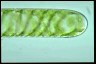 Spirogyra