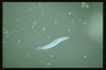 Spirostomum