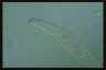 Spirostomum teres