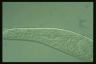 Spirostomum teres