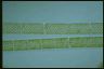 Spirogyra