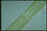 Spirogyra