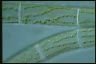 Spirogyra