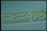 Spirogyra