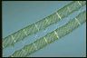 Spirogyra