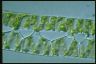 Spirogyra