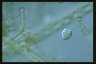 Vorticella