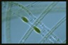 Spirogyra