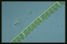 Spirogyra