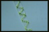 Spirogyra